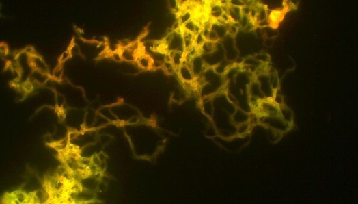 Fluorescencyjnie zobrazowana kolonia prątków gruźlicy. /źródło: wiki; Oleum (CC BY 3.0)