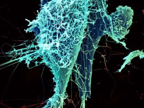 Mikrografia elektronowa cząsteczek wirusa Ebola otaczających chorą komórkę./źródło: flickr; NIAID, NIH (CC BY 2.0)