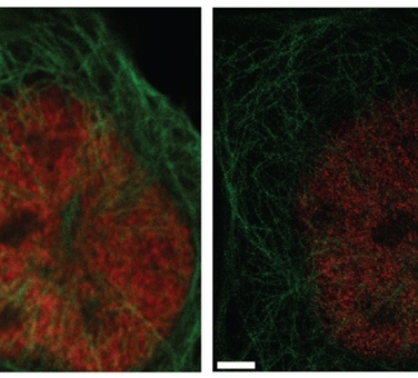 Porównanie obrazu z mikroskopu konfokalnego (po lewej) i STED (po prawej). Na zdjęciach wybarwione komórki: na czerwono oznaczone są pory jądrowe, na niebiesko - mikrotubule. /źródło: Hiersenmenzel et al., Front Endocrinol (2013)